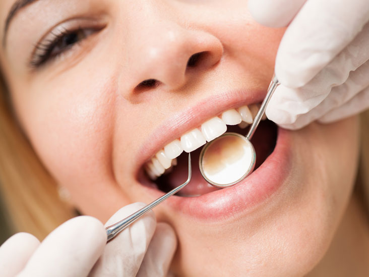 Get a Professional Teeth Cleaning